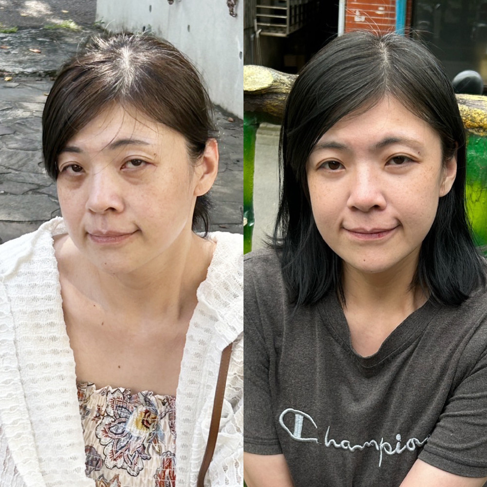眼袋消失術！視覺減齡小10歲