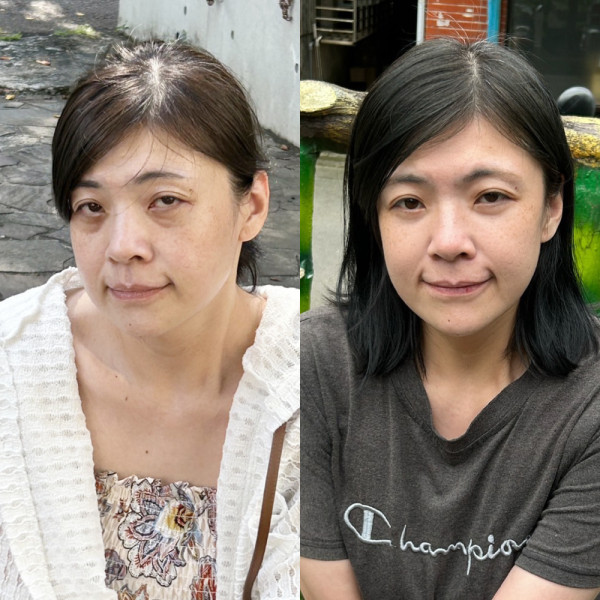 眼袋消失術！視覺減齡小10歲
