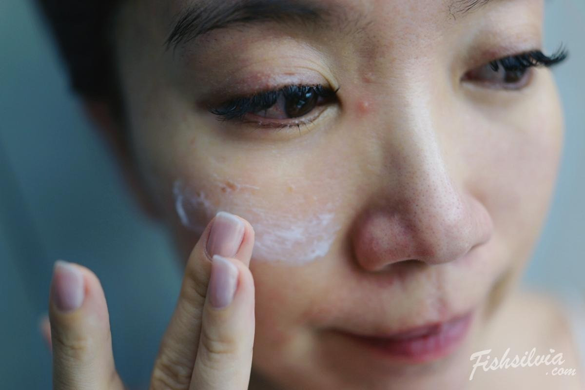 梭時療程治療痘疤與膚色不均