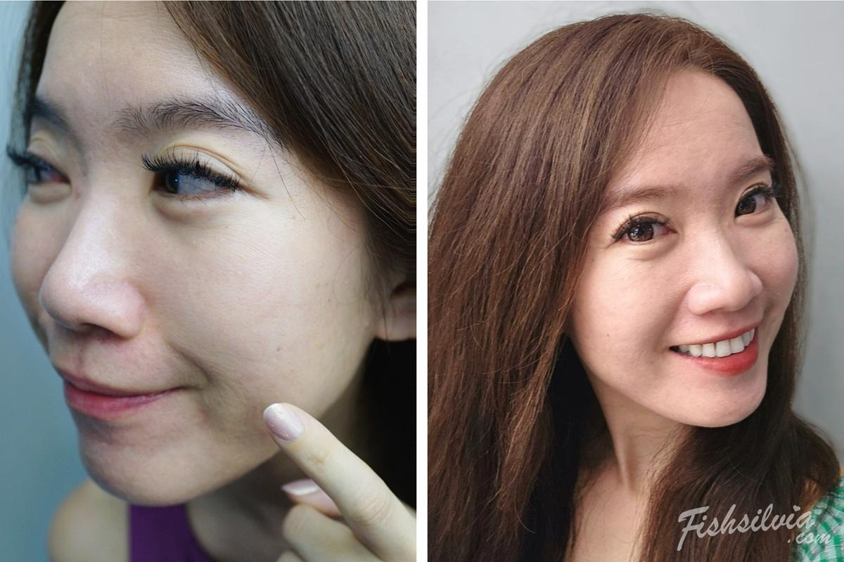 醫美療程，改善膚色暗沉